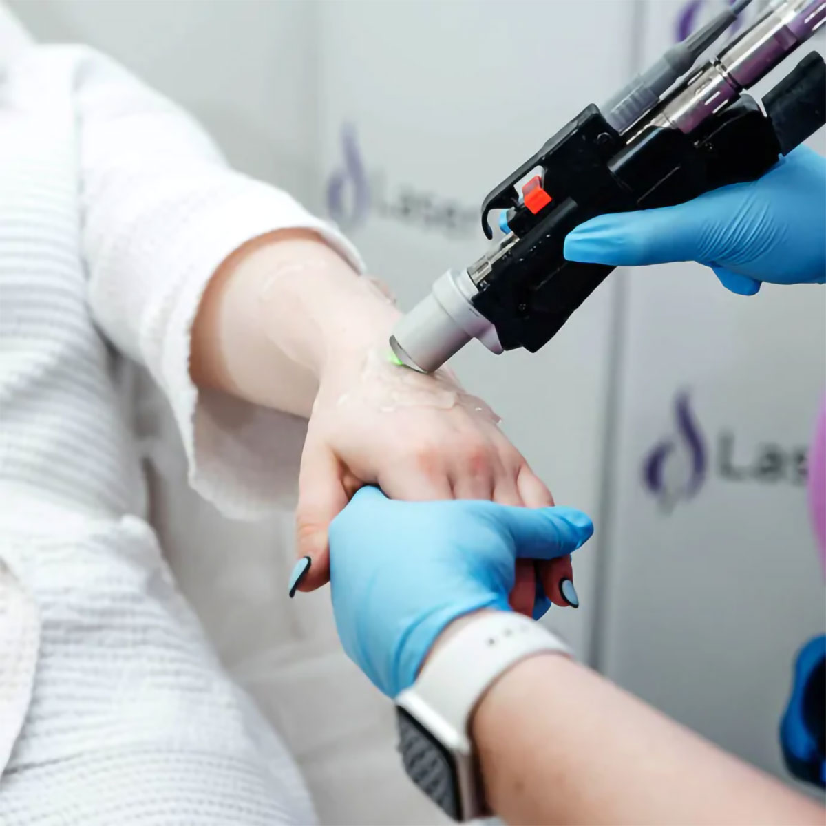 Benefits of Laser Hair Removal