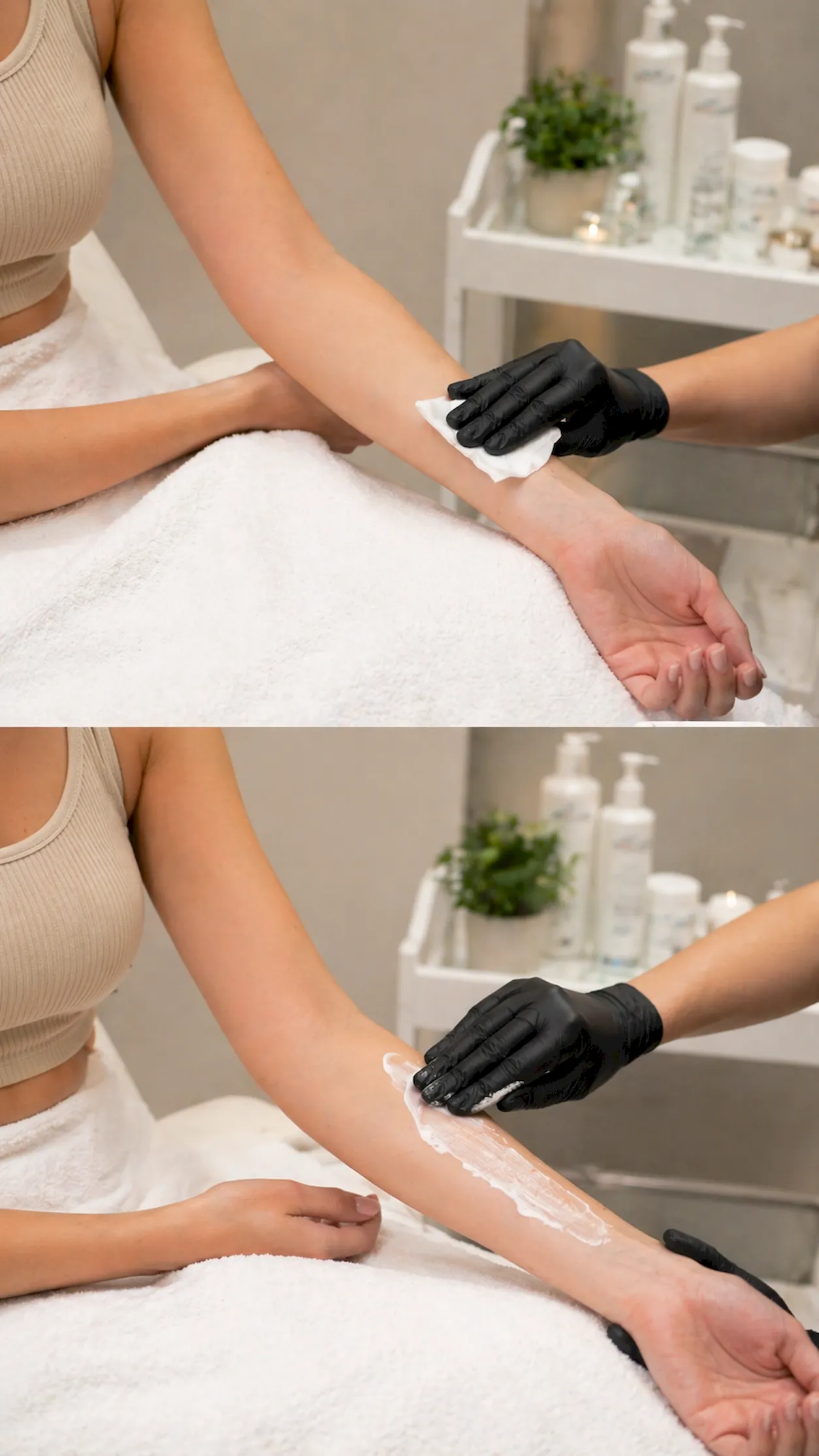 Full Arms Laser Hair Removal North York